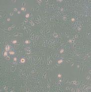 人正常宫颈上皮细胞HUCEC