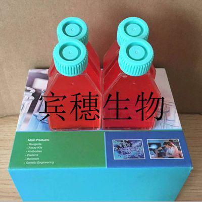 HFWT Cell;HFWT克隆细胞系(STR鉴定图谱)