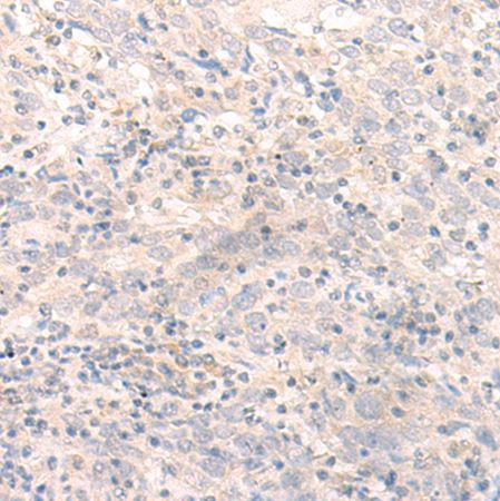 兔抗IL26多克隆抗体