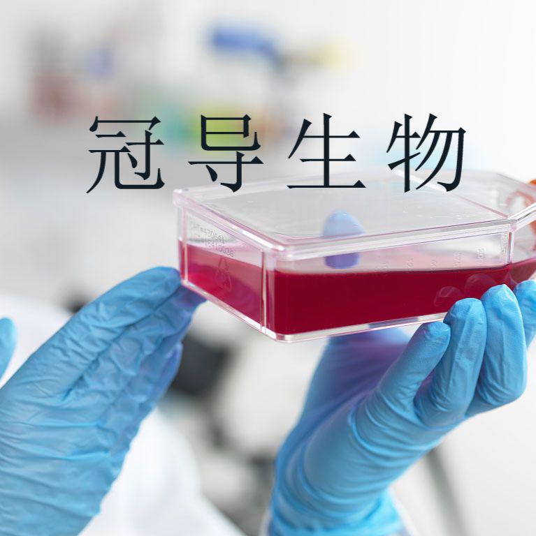 人甲状腺滤泡上皮体外复苏细胞|完全培养基