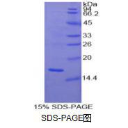 胶质细胞系来源神经营养因子(GDNF)重组蛋白（人）