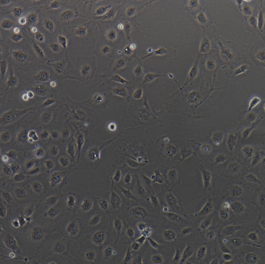 HUVEC 脐静脉内皮细胞（永生化）赠免疫荧光鉴定