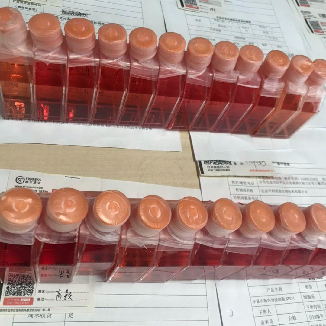 KTC-1 人甲状腺癌细胞 STR鉴定 赛百慷（iCell）