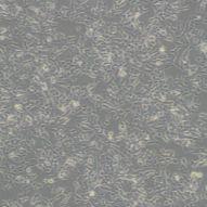 永生化人心脏微血管内皮细胞HCMECs