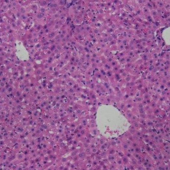 肿瘤组织HE染色服务