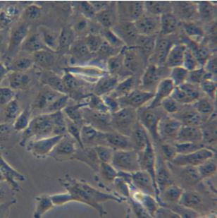 C643甲状腺癌细胞