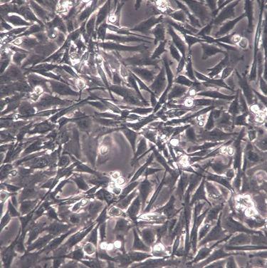 【HBZY-1】HBZY-1细胞/HBZY-1细胞/HBZY-1大鼠肾小球系膜细胞