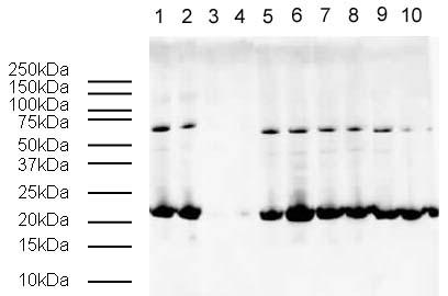 Western blot/WB/免疫印迹/蛋白质印迹
