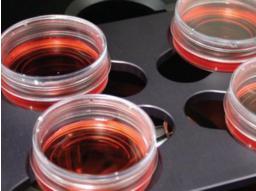 HFLS-RA ；类风湿关节炎成纤维样滑膜细胞