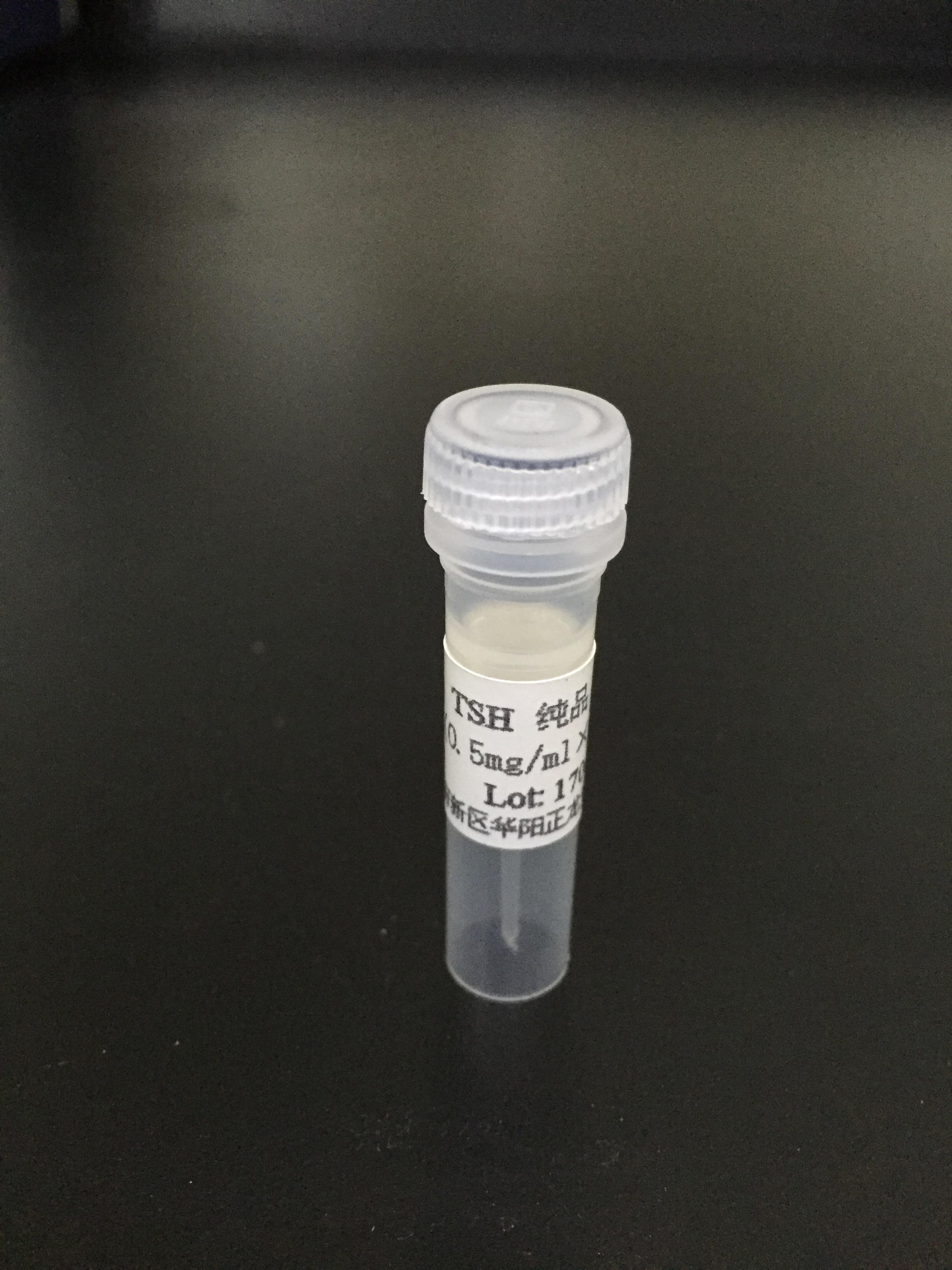 人促甲状腺激素（TSH）