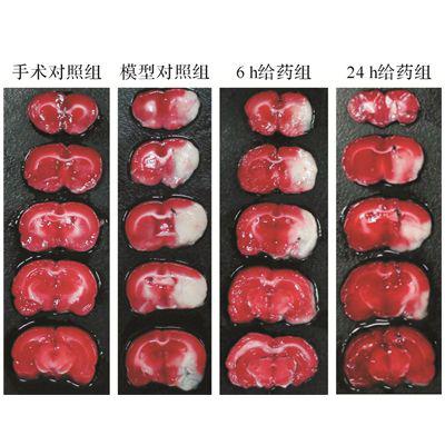 Rat心肌缺血再灌注模型