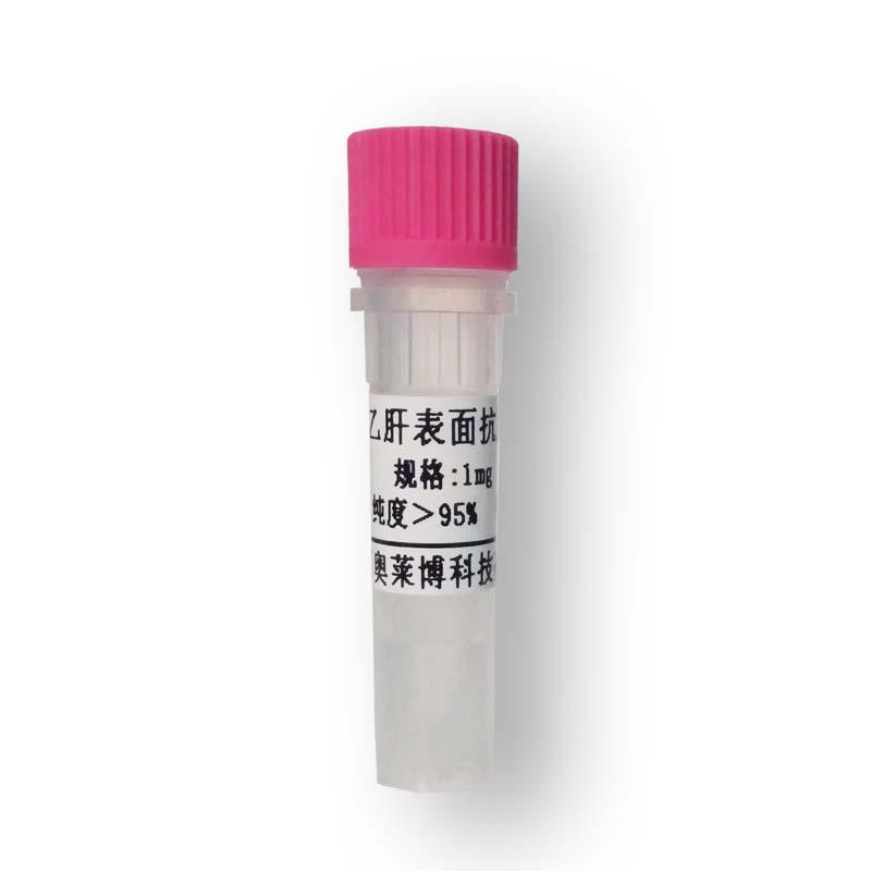 小鼠抗HIV(P24)抗体供应