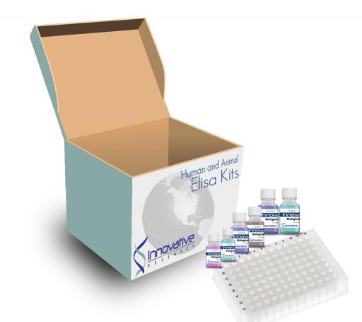 Human Cathepsin B ELISA Kit