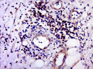 小鼠抗人红细胞单克隆免疫荧光抗体