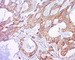 生长因子受体结合蛋白2相关蛋白3免疫荧光抗体