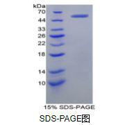 V-Myc骨髓细胞瘤病毒癌基因同源物(MYC)重组蛋白