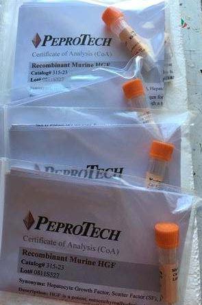 Rabbit Anti-Human VCAM-1细胞因子