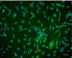 人绒毛膜间充质基质细胞