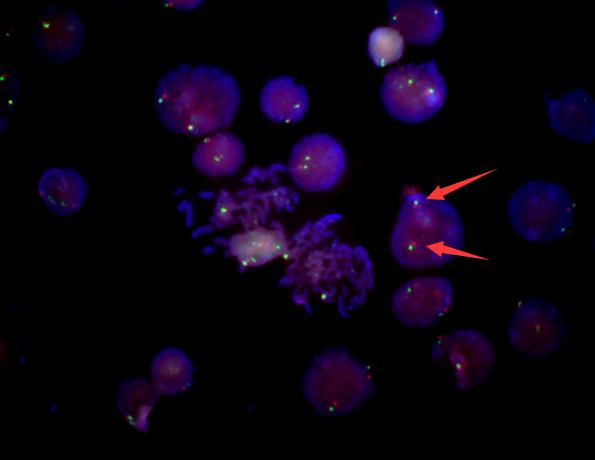 荧光原位杂交 FISH