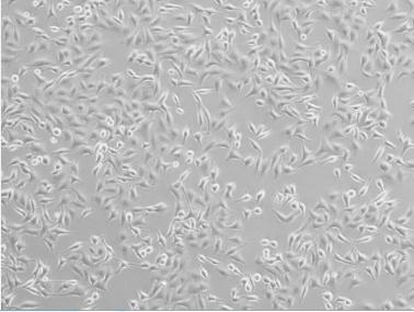 5637人膀胱癌细胞