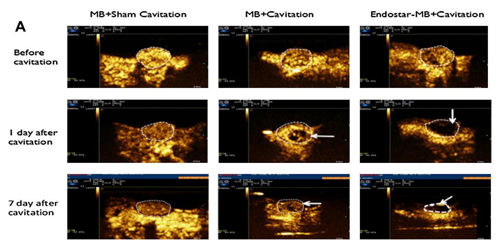 靶向微泡介导的超声治疗
