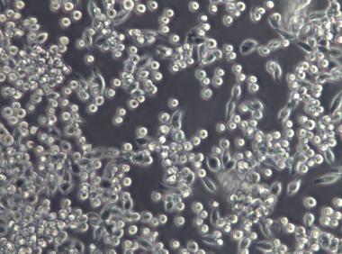 BFTC-905（人膀胱移行细胞癌）