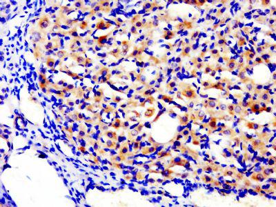 TG兔抗甲状腺球蛋白