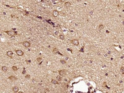 HSL/LIPE荷尔蒙敏感脂肪酶抗体