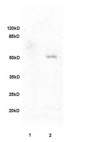 Fibulin 5衰老关键蛋白抗体