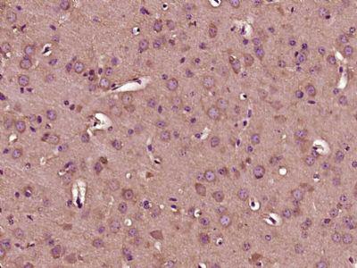 Gemin 1脊髓性肌萎缩症蛋白SMA/抗体