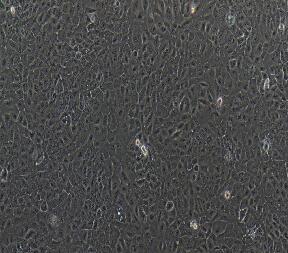 树突状细胞DC细胞