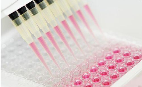 Human CTSV (Cathepsin V) ELISA Kit