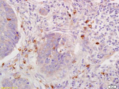 RANTES T细胞特异性趋化因子抗体