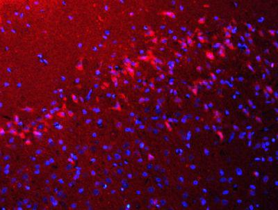 Beclin 1 Bcl-2同源结构域蛋白抗体