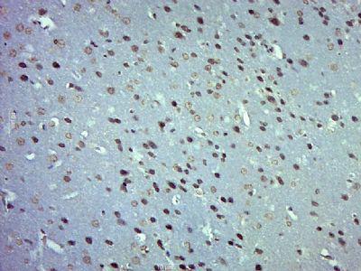 ZNF770锌指蛋白770抗体