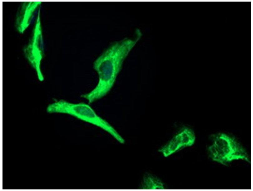 高分子量激肽原重链抗体