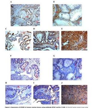 肾小球裂孔膜蛋白PDCN抗体