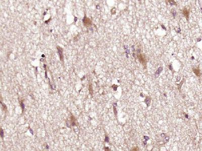 Vasopressin抗利尿激素/血管升压素/加压素/血管加压素抗体