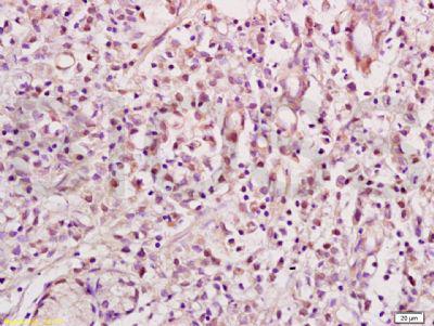 NRSF神经元抑制蛋白抗体