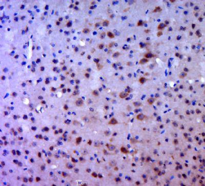 SPHK1鞘氨醇激酶1抗体