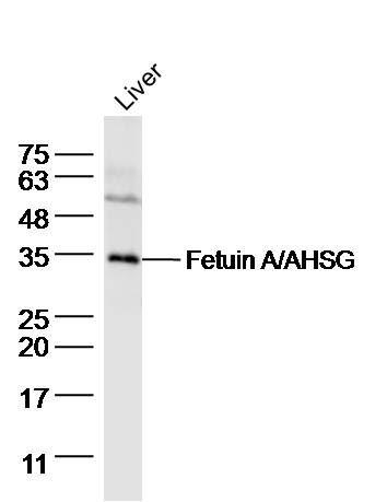 Fetuin A/AHSG胎球蛋白A