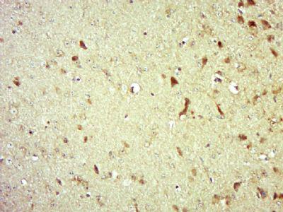 eIF3A真核翻译起始因子3A抗体