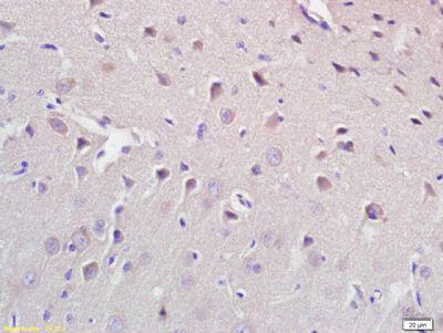 CROT肉碱氧位甲基转移酶抗体