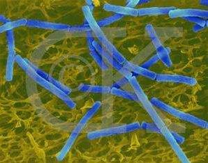 耐辐射奇异球菌