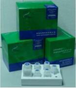 细胞P300/CBP组蛋白乙酰转移酶（P300/CBP-HAT）活性检测试剂盒（荧光）