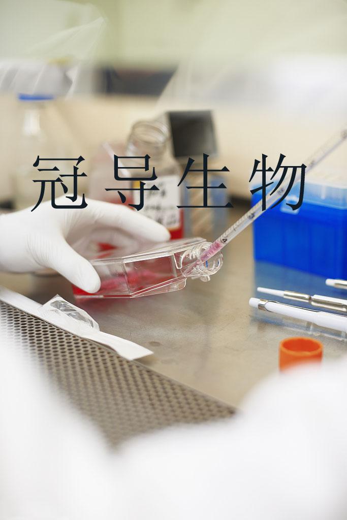 人肝星状细胞LX-2