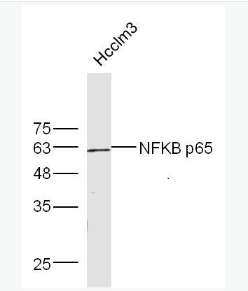 骨成型蛋白受体1A抗体