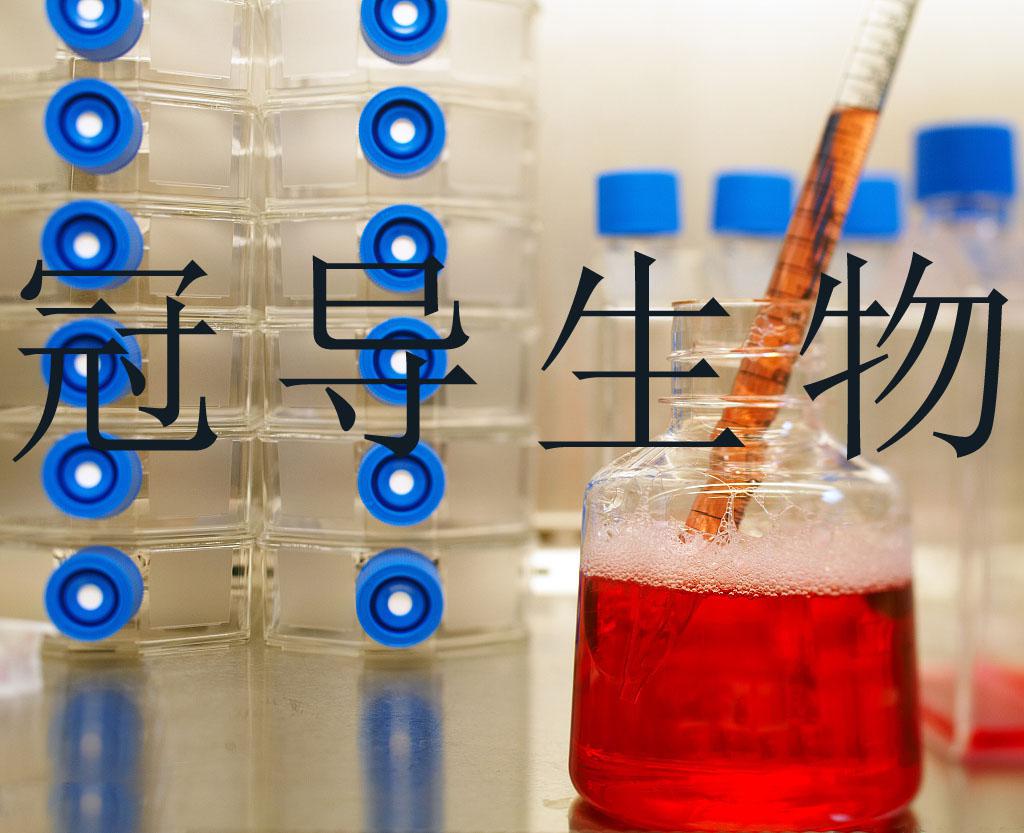 muller细胞:大鼠视网膜神经胶质细胞哪家供应