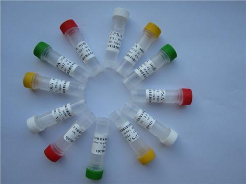 β淀粉样蛋白胞内结构域相关蛋白1抗体