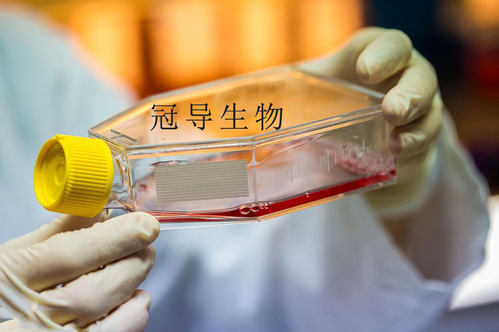 GL261细胞系(小鼠胶质瘤细胞专业复苏培养中心)